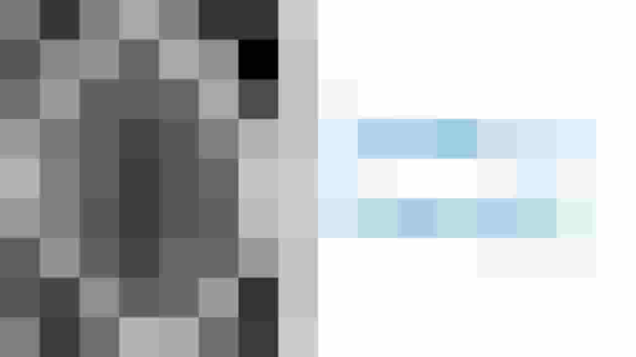 CT-Bild eines Subduralhämatoms im menschlichen Gehirn.