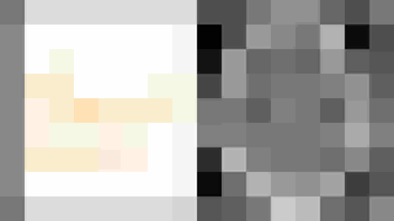 CT-Bild eines Gehirns mit dem Hinweis auf Subarachnoidalblutung.